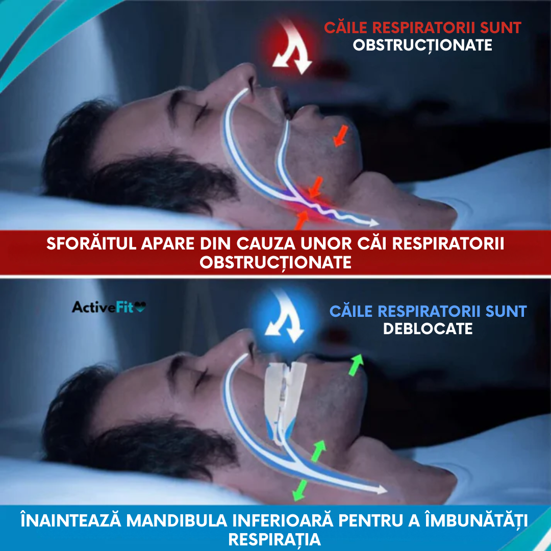Gutiera Antisforăit Sleepwell® – Odihnește-te așa cum meriți