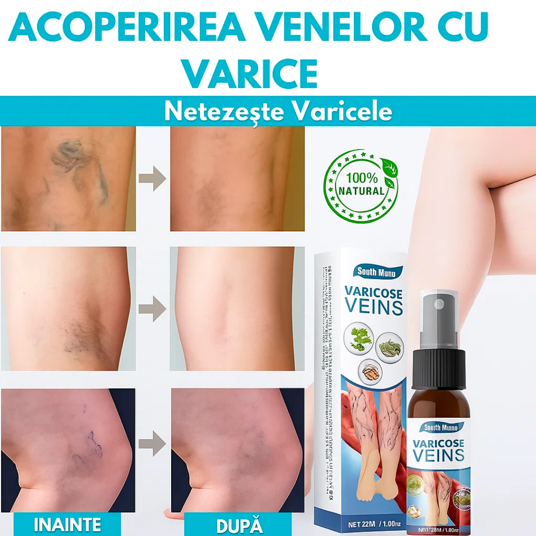Spray Anti-Varice Activefit®