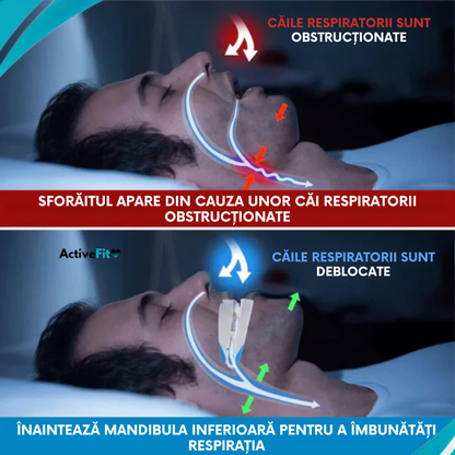 Gutiera Antisforăit Sleepwell® – Odihnește-te așa cum meriți